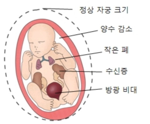 아기의 보금자리 양수에 대한 모든 것