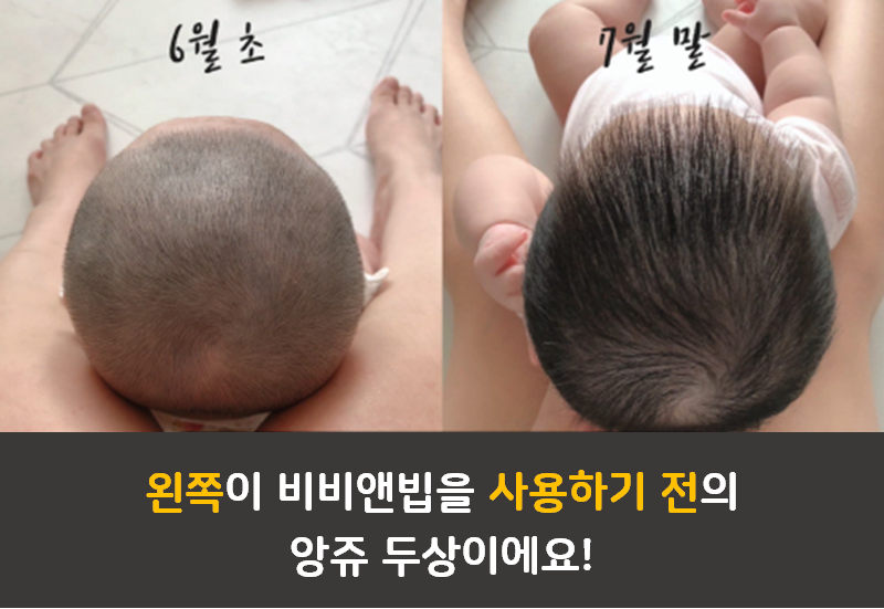 바디필로우 사용 전후 두상변화 인증